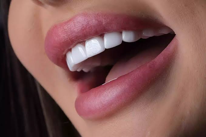 Zirkonyum Diş Kaplaması Nedir?